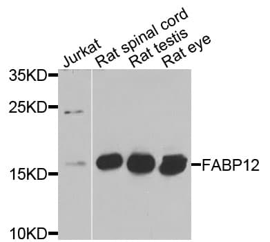 FABP12 Antibody