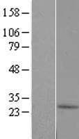 C10orf67 Protein (Over-Expression Lysate Myc-DDK (Flag))