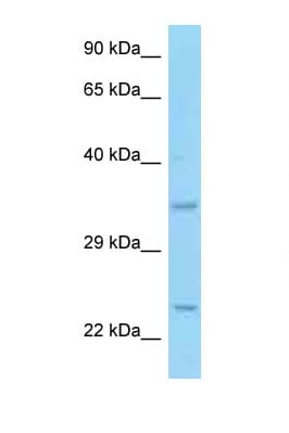 CD69 Antibody (aa98-147)