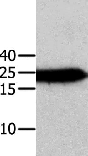 ANXA5 / Annexin V Antibody