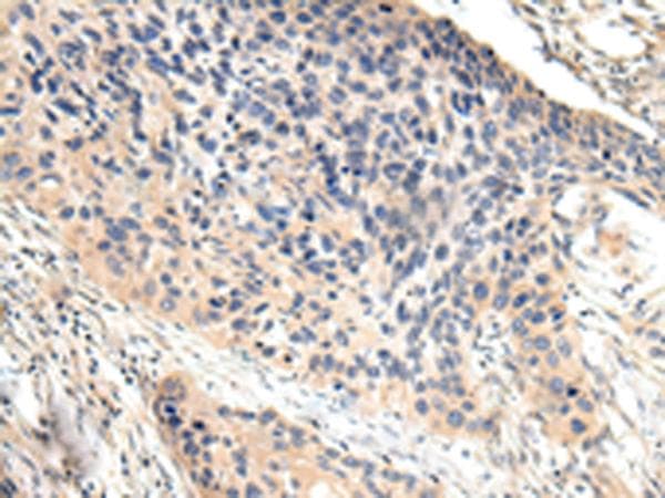 VCAM1 / CD106 Antibody