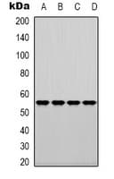 Polyclonal Rabbit anti-Human FSCN1 / Fascin Antibody (Internal, WB)