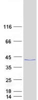 Human KLHDC9 Protein (Recombinant Myc-DDK (Flag))