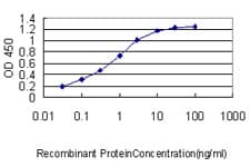 IHC-plus™ FLNA / Filamin A Antibody (clone 4E10-1B2)