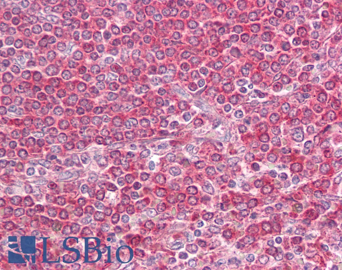 IHC-plus™ Polyclonal Rabbit anti-Human MD-1 / LY86 Antibody (aa112-125, IHC, WB)