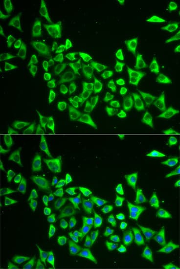 MRPS30 Antibody