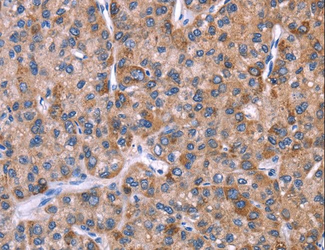 EVC2 Antibody