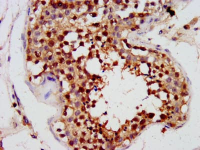 Polyclonal Rabbit anti-Human PHOX2A Antibody (IHC)