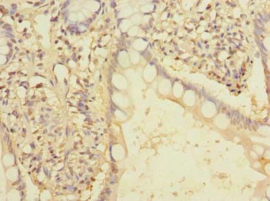 EEF2KMT / FAM86A Antibody (aa1-330)