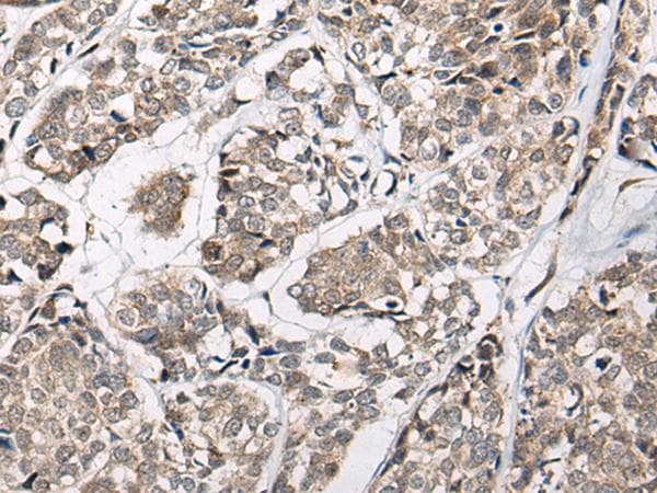CACNB3 / Cavbeta3 Antibody