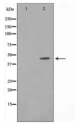 Polyclonal Rabbit anti-Human NFKBIE / IKB Epsilon Antibody (IHC, IF, WB)