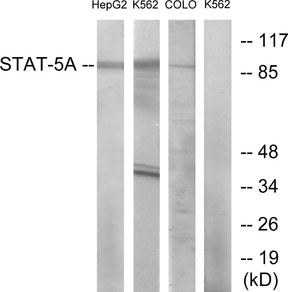 STAT5A Antibody (aa666-715)