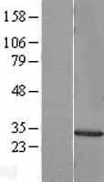 MMP7 / Matrilysin Protein (Over-Expression Lysate Myc-DDK (Flag))