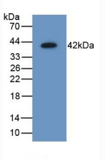 AIMP1 / EMAP II Antibody (aa2-310)
