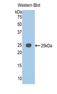 JAG1 / Jagged 1 Antibody (aa836-1047, HRP)