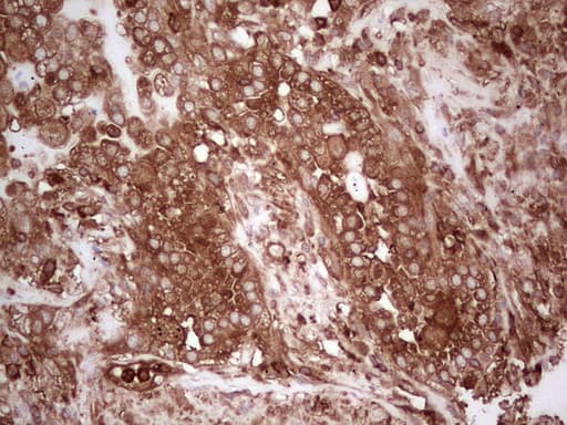 PKM2 Antibody (clone OTI11G10, Carrier-free)