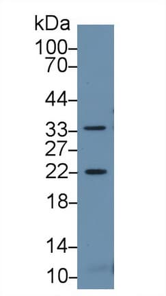 HSPB2 / HSP27 Antibody (aa12-170, Cy3)