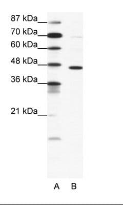 Polyclonal Rabbit anti-Human GABRP Antibody (aa28-77, WB)