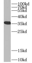 VDAC1 / PORIN Antibody