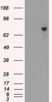 BTK Antibody (clone OTI15G8)