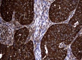 NME1 / NM23 Antibody (clone OTI6E8)
