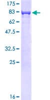 Human CBS Protein (Recombinant GST)