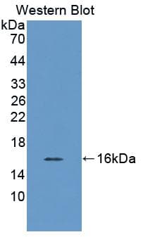 SCP2 / SCPX Antibody (APC)