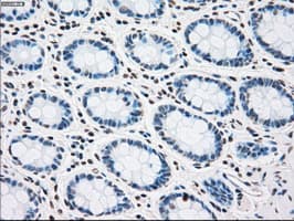 PLK1 / PLK-1 Antibody (clone OTI6C6)