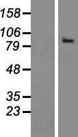 THSD1 / TMTSP Protein (Over-Expression Lysate Myc-DDK (Flag))