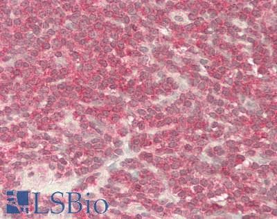 IHC-plus™ Monoclonal Mouse-Balb/c anti-Human DGKA Antibody (clone M6, IHC, WB)