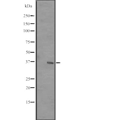 Polyclonal Rabbit anti-Human CGI-96 / RRP7A Antibody (WB)