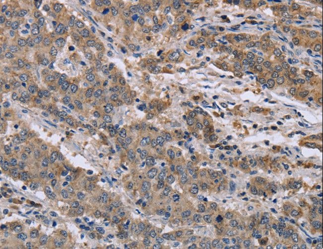 GSN / Gelsolin Antibody