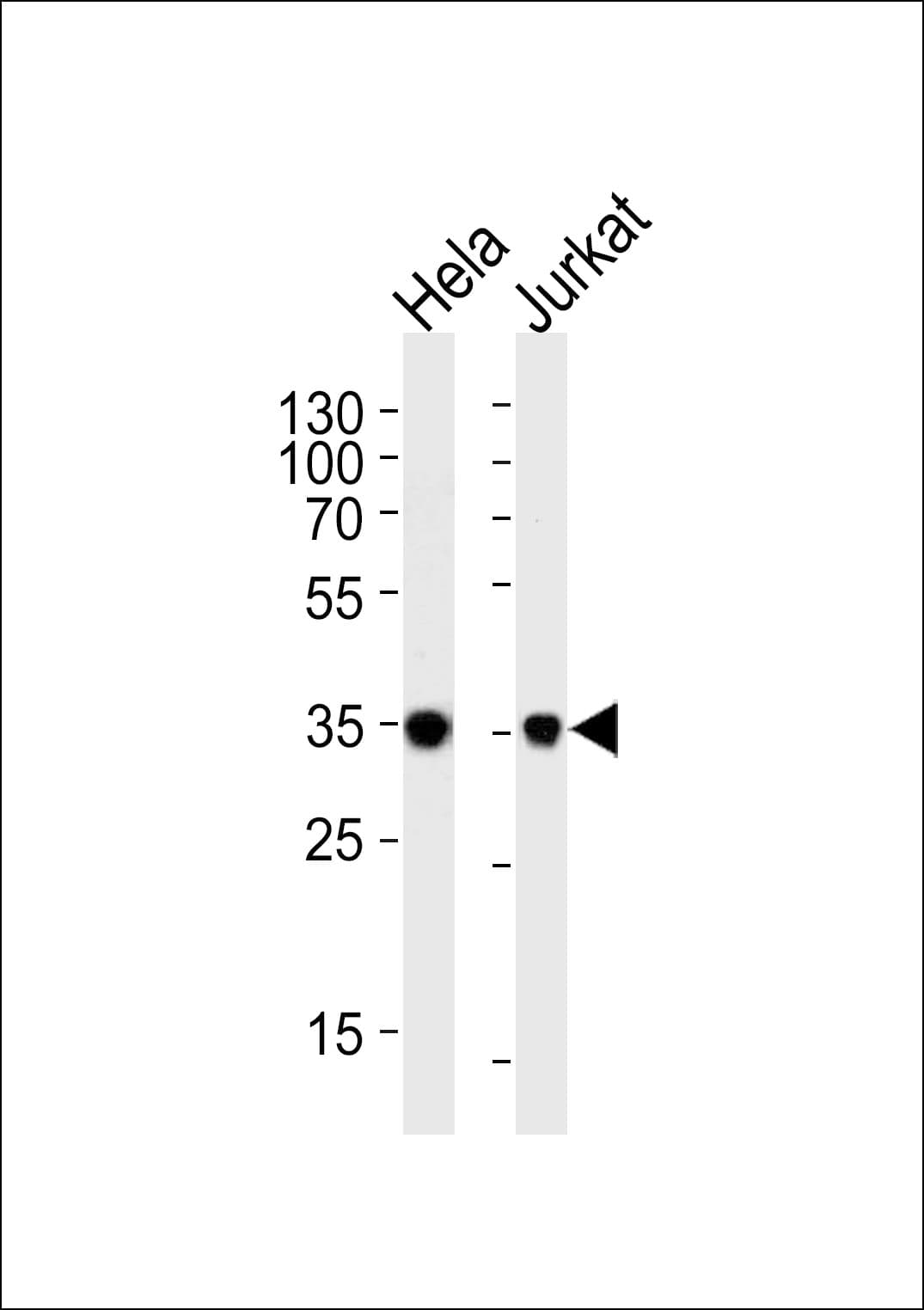FRG1 Antibody (aa230-256)