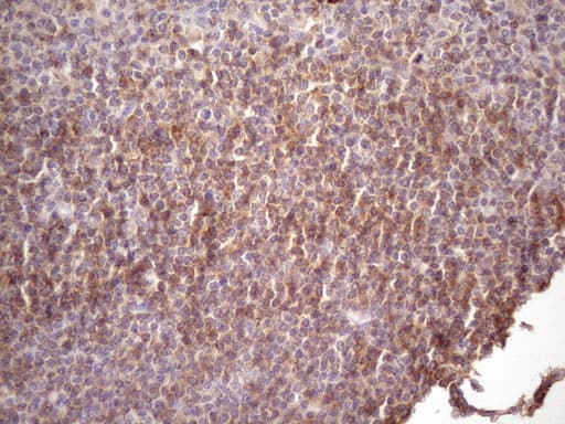 Monoclonal Mouse anti-Human CD22 Antibody (clone OTI2E6, aa707-847, IHC, WB)