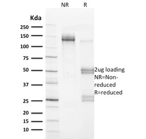 VCL / Vinculin Antibody (clone VCL/2572)