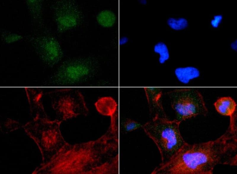 TP53INP2 Antibody