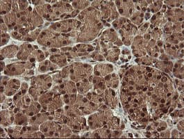 TRMT2A Antibody (clone OTI1C3)