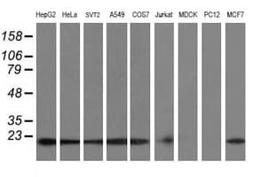 IHC-plus™ COMMD1 Antibody (clone 2E2)