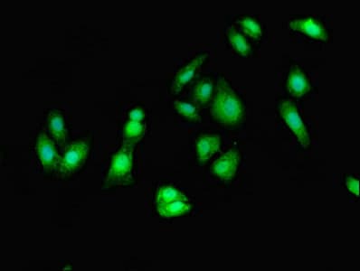 IHC-plus™ Polyclonal Rabbit anti-Human EEF2 / Elongation Factor 2 Antibody (aa2-858, IHC)