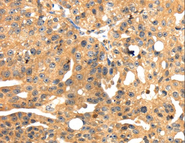 Polyclonal Rabbit anti-Human SH3KBP1 / CIN85 Antibody (IHC)