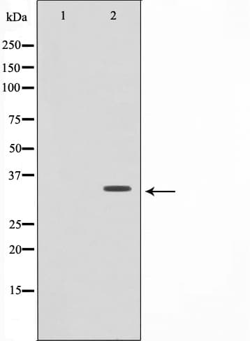 Polyclonal Rabbit anti-Human TNFRSF6B / DCR3 Antibody (IHC, IF, WB)