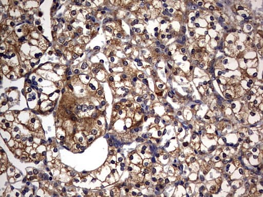 IL1RN Antibody (clone OTI3B1)