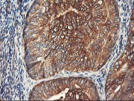 PFKP Antibody (clone OTI1F2)