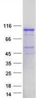 Human EXD3 Protein (Recombinant Myc-DDK (Flag))