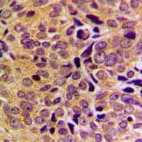 GAS8 Antibody (Internal)
