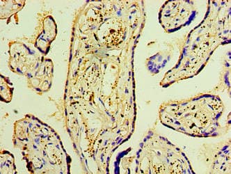 Polyclonal Rabbit anti-Human DNAH3 Antibody (aa1-150, IHC)