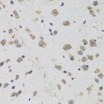 IHC-plus™ Polyclonal Rabbit anti-Human OPRS1 / SIGMAR1 Antibody (IHC, WB)