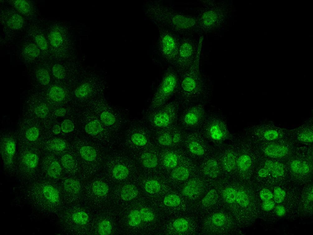 SETD1B / SET1B Antibody