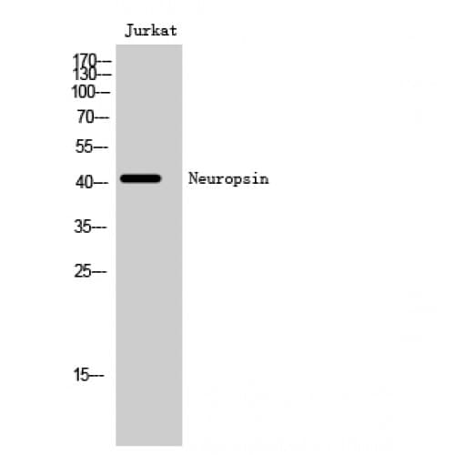OPN5 / Neuropsin Antibody (220-300 aa, C-terminal)