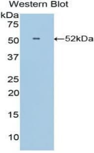 IFNA8 / Interferon Alpha 8 Antibody (aa24-189)